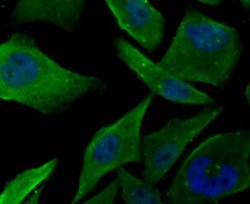 Muscle Phosphofructokinase/PFKM/PFK-1 Rabbit anti-Human, Mouse, Rat, Clone: