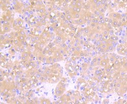 Muscle Phosphofructokinase/PFKM/PFK-1 Rabbit anti-Human, Mouse, Rat, Clone: