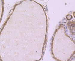 Muscle Phosphofructokinase/PFKM/PFK-1 Rabbit anti-Human, Mouse, Rat, Clone: