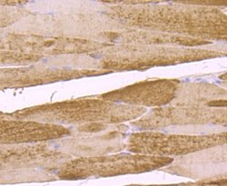 Muscle Phosphofructokinase/PFKM/PFK-1 Rabbit anti-Human, Mouse, Rat, Clone: