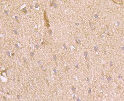 Muscle Phosphofructokinase/PFKM/PFK-1 Rabbit anti-Human, Mouse, Rat, Clone: