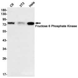 Muscle Phosphofructokinase/PFKM/PFK-1 Antibody (S08-6B4), Novus Biologicals