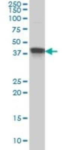 Muscleblind-like 1 Antibody (1D11), Novus Biologicals 0.1 mg | Buy Online | Novus Biologicals | Fisher Scientific