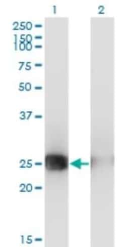 Musculin Antibody (4D7), Novus Biologicals 0.1 mg | Buy Online | Novus Biologicals | Fisher Scientific