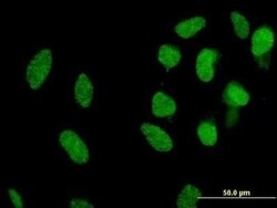 Mxi1 Antibody (1B10), Novus Biologicals 0.1 mg | Buy Online | Novus Biologicals | Fisher Scientific