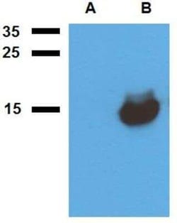 Mycobacterium tuberculosis antigen Acr1 Antibody, Novus Biologicals 0.1