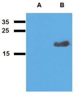 Mycobacterium tuberculosis antigen Acr2 Antibody, Novus Biologicals 0.1