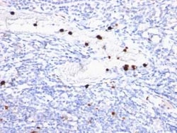 Myeloid-Associated Differentiation Marker Antibody (MYADM/972), Novus Biologicals:Antibodies:Primary