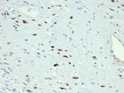 MyoD Rabbit anti-Human, Clone: MYOD1/3418R, Novus Biologicals 100 &mu;g;