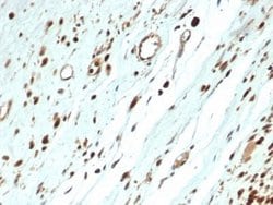 MyoD Rabbit anti-Human, Clone: MYOD1/3418R, Novus Biologicals 100 &mu;g;