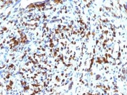 MyoD Antibody (MYOD1/2075R), Novus Biologicals 20 &mu;g; Unconjugated:Antibodies,