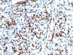 MyoD Antibody (MYOD1/2075R), Novus Biologicals 20 &mu;g; Unconjugated:Antibodies,