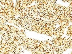 Novus Biologicals MyoD Antibody (SPM427) - Azide and BSA Free, Novus Biologicals
