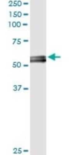 Myocilin Antibody (4F8), Novus Biologicals 50 &mu;g | Buy Online | Novus Biologicals | Fisher Scientific