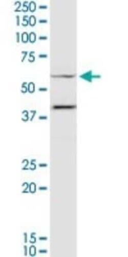 Myocilin Antibody, Novus Biologicals 0.1 mg | Buy Online | Novus Biologicals | Fisher Scientific