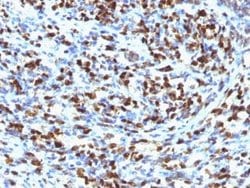 Myogenin Antibody (MGN185), Novus Biologicals 20 &mu;g, Unlabeled:Antibodies,