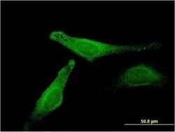 Myoglobin Antibody (4F8), Novus Biologicals 0.1 mg | Buy Online | Novus Biologicals | Fisher Scientific