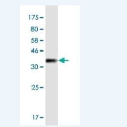 Myosin 1E Antibody (7A5), Novus Biologicals 100 &mu;g | Buy Online | Novus Biologicals | Fisher Scientific