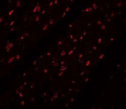Myosin Heavy Chain 3 Antibody - BSA Free, Novus Biologicals 0.1 mg; Unconjugated:Antibodies,