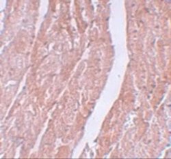Myosin Heavy Chain 3 Antibody - BSA Free, Novus Biologicals 0.1 mg; Unconjugated:Antibodies,