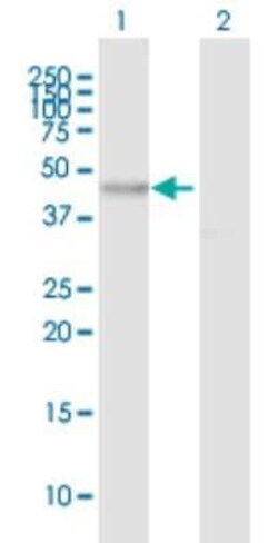 Novus Biologicals Myosin-Id Antibody, Novus Biologicals 0.05 mg | Buy Online | Novus Biologicals&trade; | Fisher Scientific