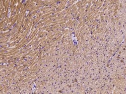 Myosin Light Chain 2 Antibody, Novus Biologicals 100 &mu;g; Unconjugated:Antibodies,