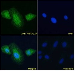 Myosin Phosphatase Antibody, Novus Biologicals 100 &mu;g; Unconjugated:Antibodies,
