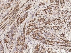 Myosin heavy chain 11 Rabbit anti-Human, Clone: 160, Novus Biologicals