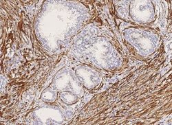 Myosin heavy chain 11 Rabbit anti-Human, Clone: 160, Novus Biologicals