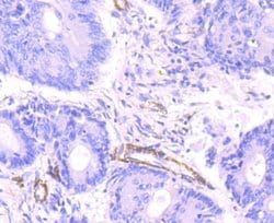 Myosin heavy chain 11 Antibody (JA03-35), Novus Biologicals 100&mu;L:Antibodies,
