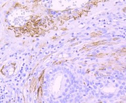 Myosin heavy chain 11 Antibody (JA03-35), Novus Biologicals 100&mu;L:Antibodies,