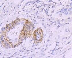 Myosin heavy chain 11 Antibody (JA03-35), Novus Biologicals 100&mu;L:Antibodies,