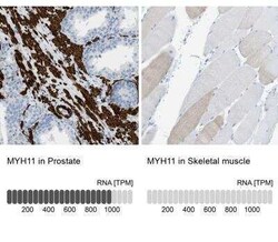 Myosin heavy chain 11 Antibody, Novus Biologicals:Antikörper:Primärantikörper