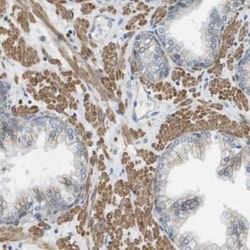 Myosin heavy chain 11 Antibody, Novus Biologicals:Antibodies:Primary Antibodies