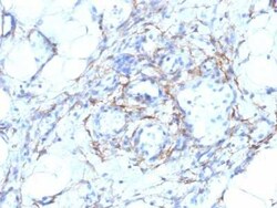 Myosin heavy chain 11 Antibody (MYH11/923 + SMMS-1), Novus Biologicals 0.02 mg | Buy Online | Novus Biologicals | Fisher Scientific