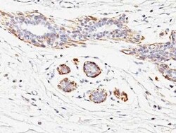 Myosin heavy chain 11 Antibody (MYH11/923), Novus Biologicals:Antibodies:Primary