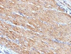 Myosin heavy chain 11 Antibody (MYH11/923), Novus Biologicals:Antibodies:Primary
