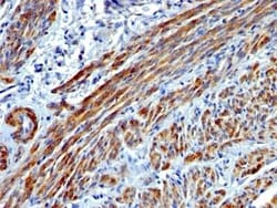 Myosin heavy chain 11 Antibody (MYH11/923), Novus Biologicals:Antibodies:Primary