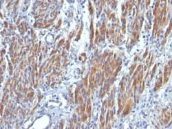 Myosin heavy chain 11 Antibody (SMMS-1), Novus Biologicals 0.1mg; Unlabeled:Antibodies,