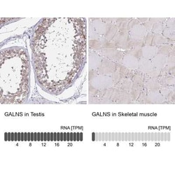 N-Acetylgalactosamine-6-Sulfatase/GALNS Antibody, Novus Biologicals 25ul;