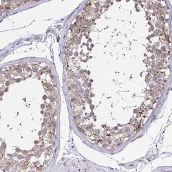 N-Acetylgalactosamine-6-Sulfatase/GALNS Antibody, Novus Biologicals 25ul;