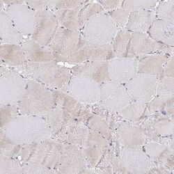 N-Acetylgalactosamine-6-Sulfatase/GALNS Antibody, Novus Biologicals 25ul;
