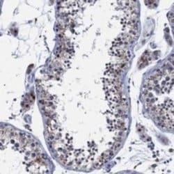 N-Acetylgalactosamine-6-Sulfatase/GALNS Rabbit anti-Human, Polyclonal,