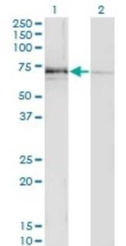 N-Acetylglucosaminyltransferase III/MGAT3 Antibody (1C9), Novus Biologicals 0.1 mg | Buy Online | Novus Biologicals | Fisher Scientific