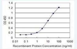 N-Acetylglucosaminyltransferase V/MGAT5 Antibody (3E9), Novus Biologicals 0.1 mg | Buy Online | Novus Biologicals | Fisher Scientific