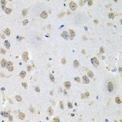 N-Acetylmannosamine Kinase/GNE Antibody - BSA Free, Novus Biologicals 0.02