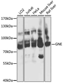 N-Acetylmannosamine Kinase/GNE Antibody - BSA Free, Novus Biologicals 0.02