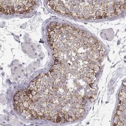 N-Cadherin Antibody (CL3716), Novus Biologicals 100&mu;L:Antibodies, Monoclonal