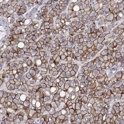 N-Cadherin Antibody (CL3716), Novus Biologicals 100&mu;L:Antibodies, Monoclonal