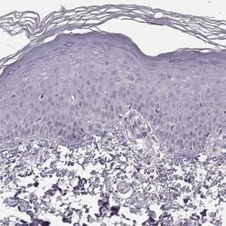 N-Cadherin Antibody (CL3716), Novus Biologicals 100&mu;L:Antibodies, Monoclonal